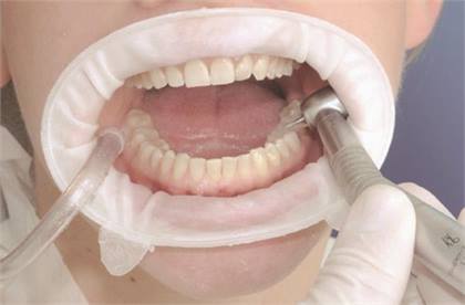 Optragate Junior Refills product image