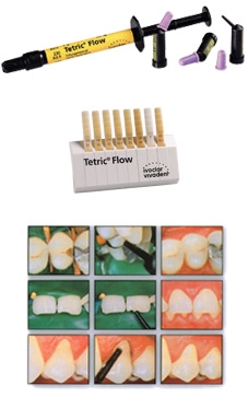 IPS Empress Direct Opaque Composite, Light-Cure, Syringe Refill, 1.8 g, Universal Viscosity, Opaque, 1/Pk, 637897 thumbnail 4